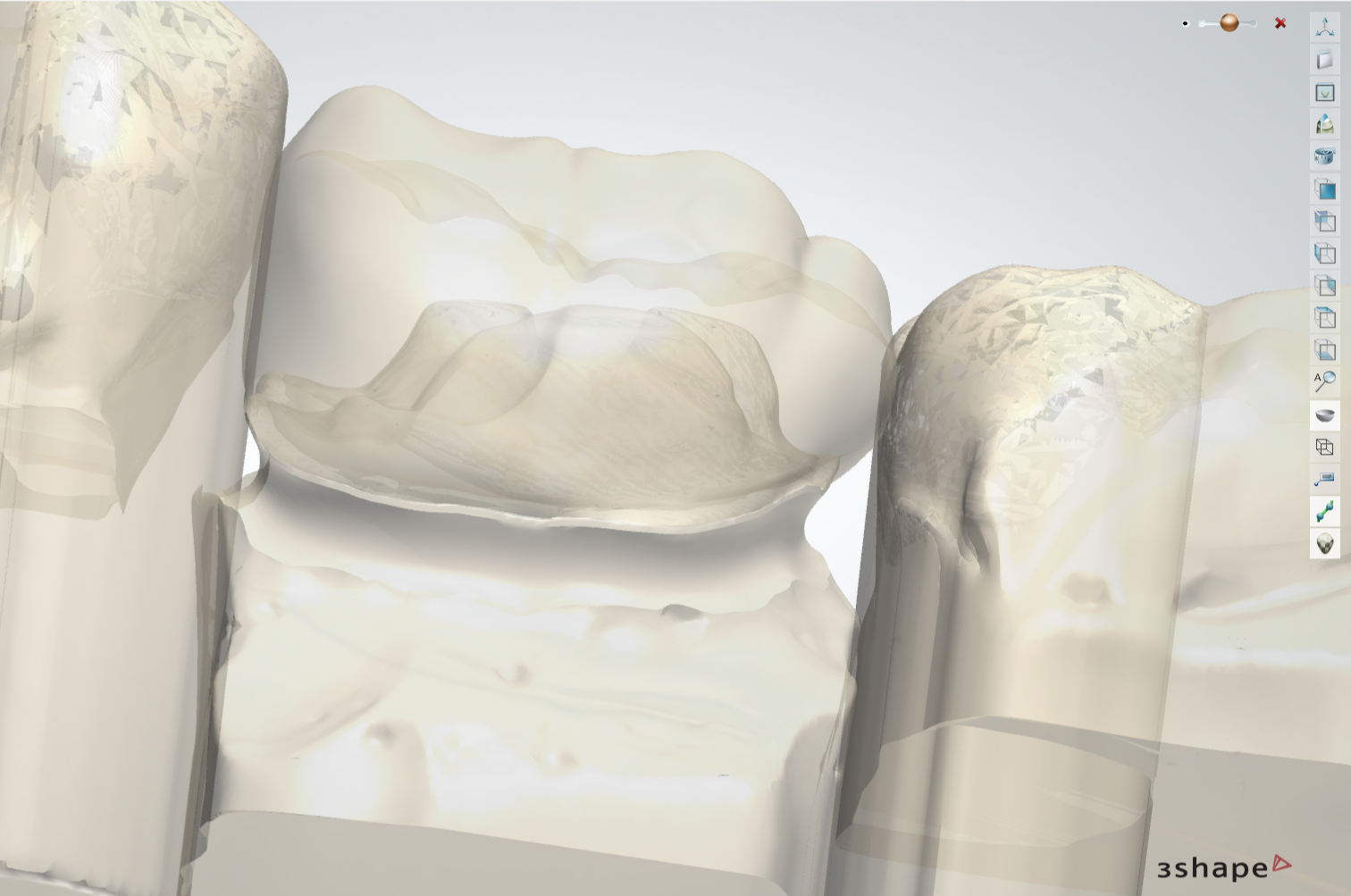 Is onafhankelijk tandtechnisch ontwerp nog rendabel in het tijdperk van Dental Design Services? schermafbeelding 2025 12 14 225758